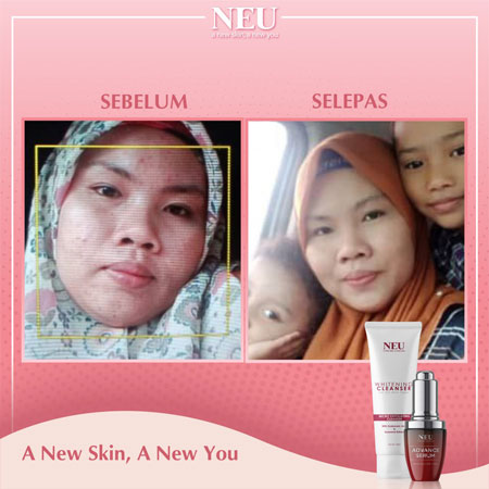 testimoni-neu-serum-8